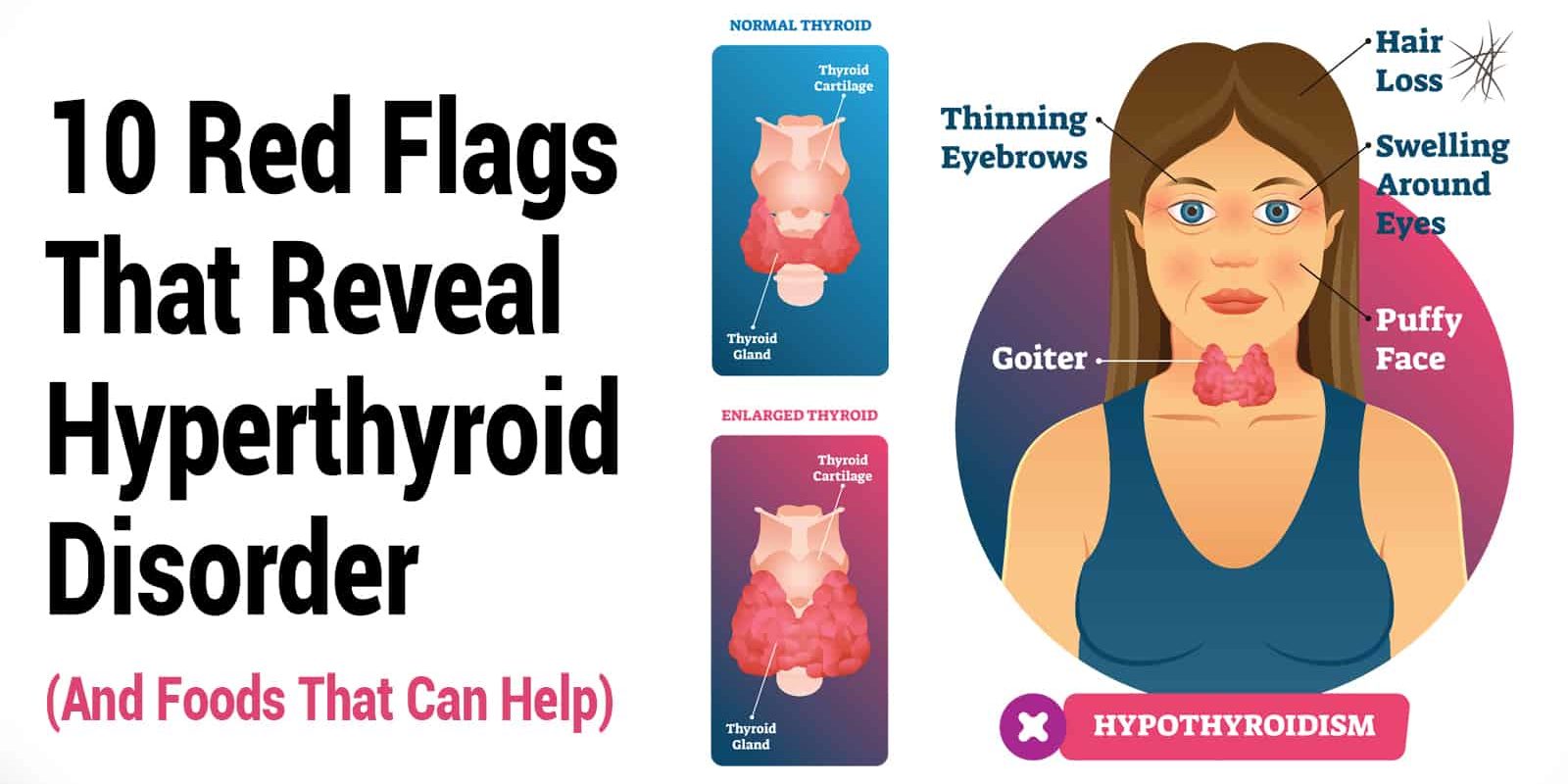 10 Red Flags That Reveal Hyperthyroid Disorder (And Foods That Can Help