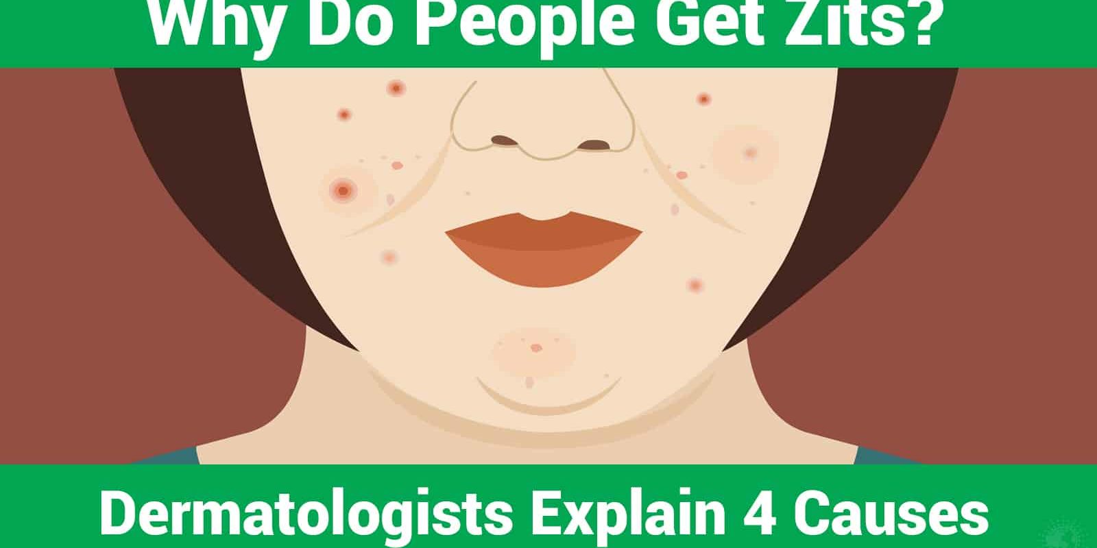 Why Do People Get Zits? Dermatologists Explain 4 Causes Stuff! Lovely!