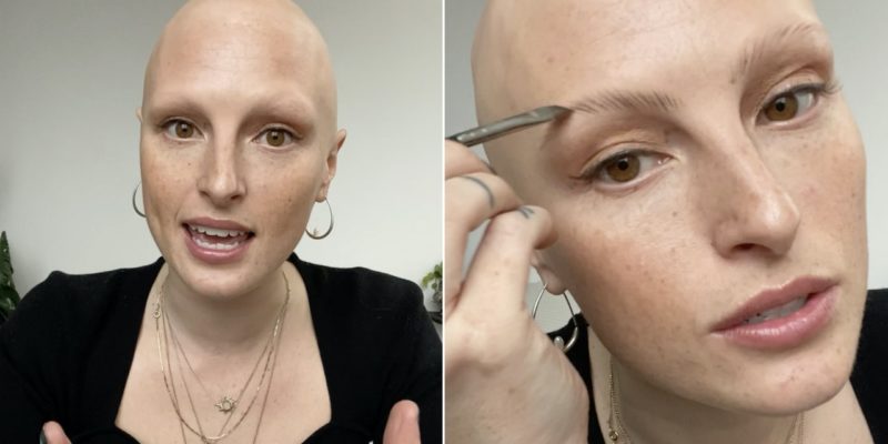 Model Amber Jean Rowan Created the Alopecia Community She Never Had ...