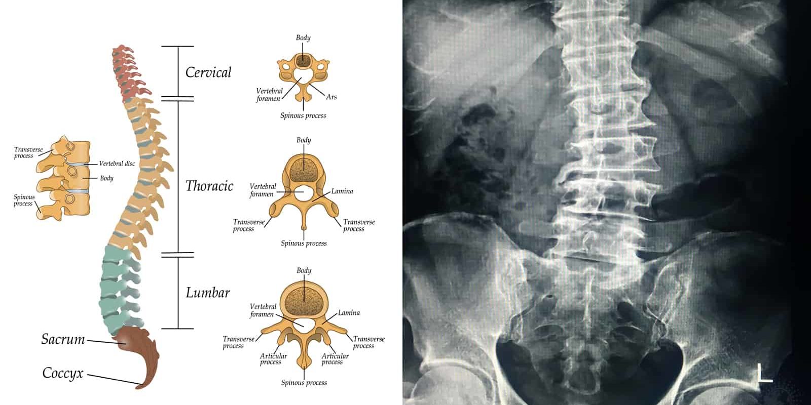 15 Habits That Improve Spinal Alignment and Reduce Back Pain – Stuff