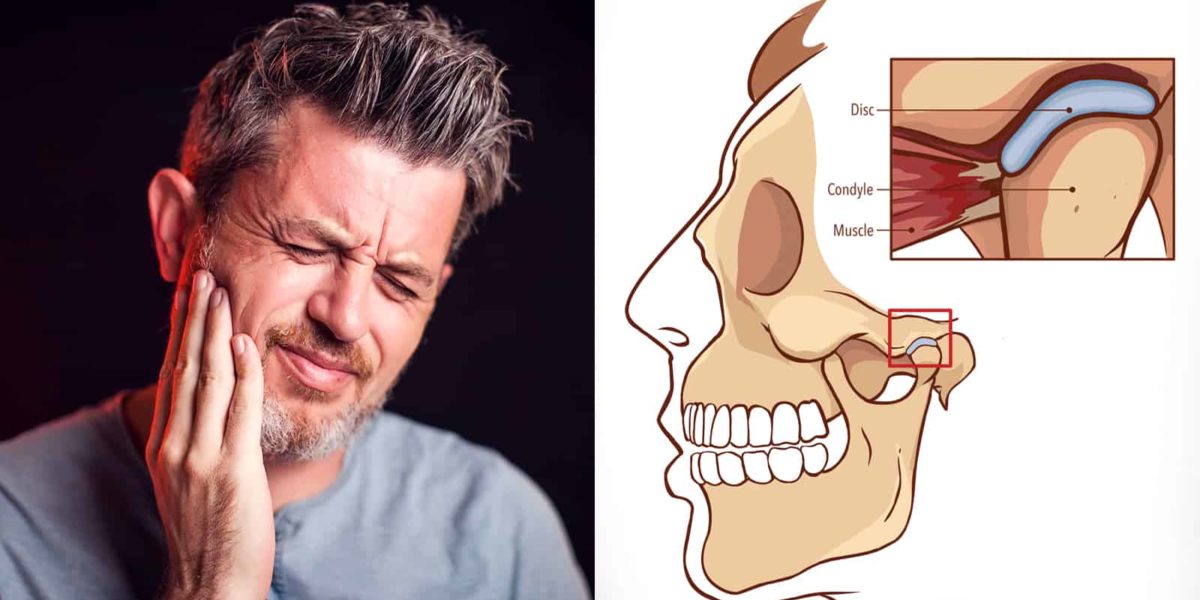 10 Things That Might Cause Jaw Pain Stuff! Lovely!