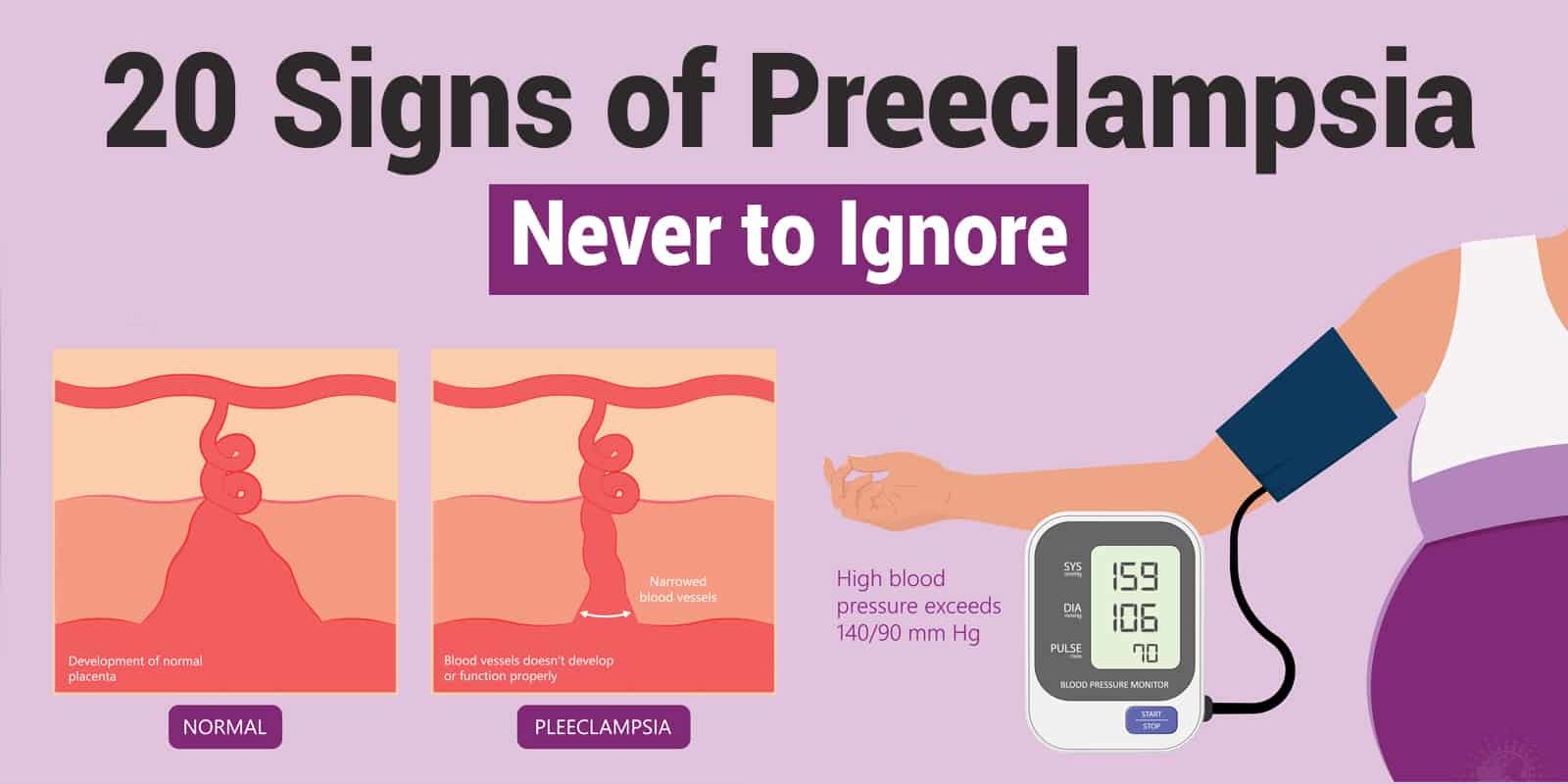 20 Signs of Preeclampsia Never to Ignore Stuff! Lovely!
