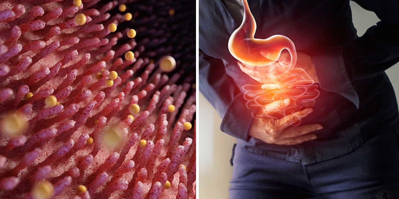 11 Times Poor Digestion Might Mean Something Worse Stuff! Lovely!